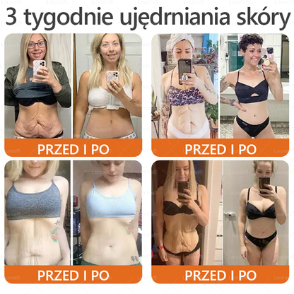 Leurea® Krem z Jadem Pszczelim 🔥 Regeneracja skóry, redukcja zmarszczek i promienny wygląd – 50 ml