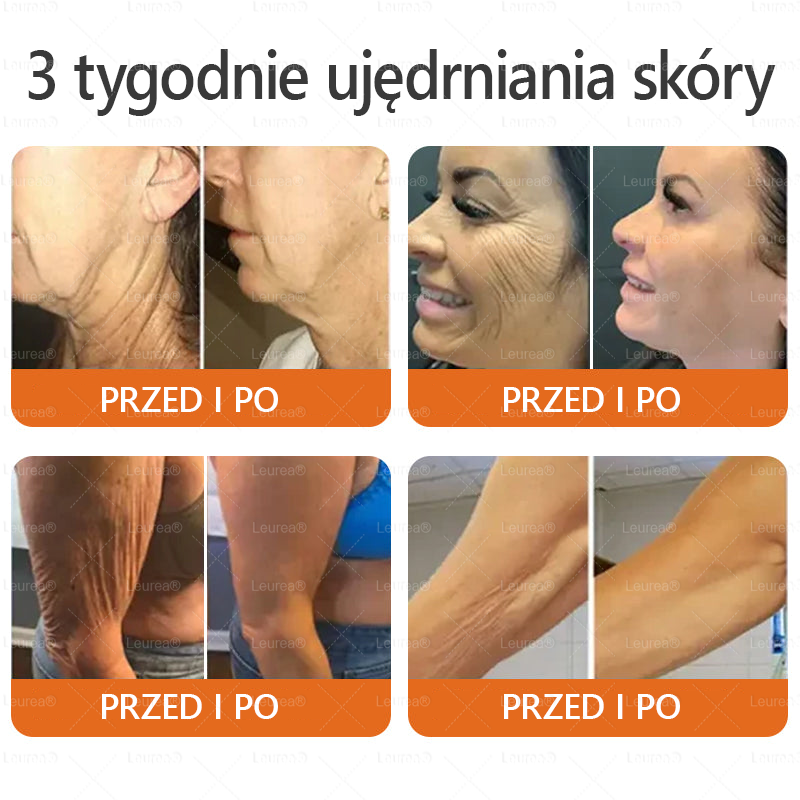 ✨Leurea® Krem Regenerujący z Jadem Pszczelim🔥 Naturalna regeneracja skóry, wygładzenie zmarszczek i promienna cera-50 ml