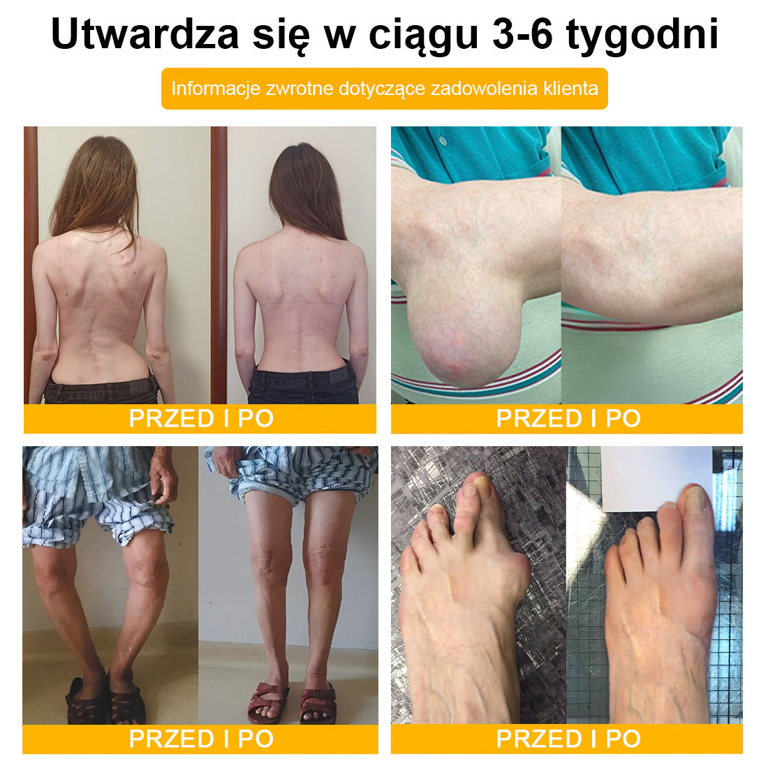 PL🐝TLOPA® Toksyna botulinowa i jad pszczeli Krem przeciwbólowy do gojenia kości🐝