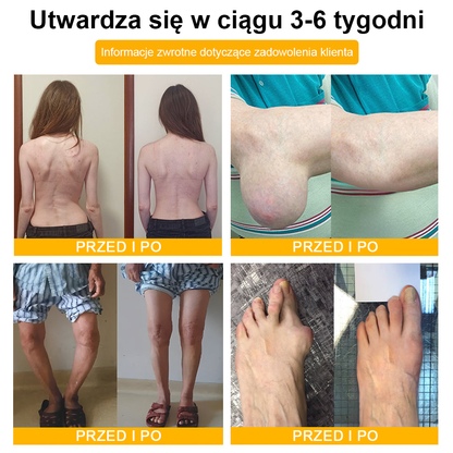 PL🐝TLOPA® Toksyna botulinowa i jad pszczeli Krem przeciwbólowy do gojenia kości🐝