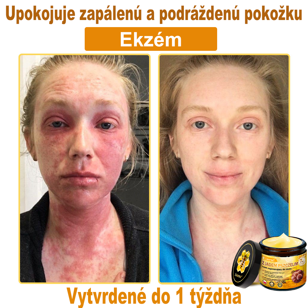 ⚡⚡Leurea® Krem z Jadem Pszczelim 🔥 Regeneracja skóry, redukcja zmarszczek i promienny wygląd – 50 ml
