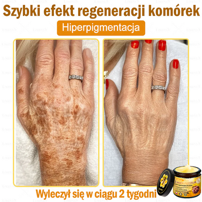 ⚡⚡Leurea® Krem z Jadem Pszczelim 🔥 Regeneracja skóry, redukcja zmarszczek i promienny wygląd – 50 ml