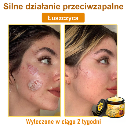 ⚡⚡Leurea® Krem z Jadem Pszczelim 🔥 Regeneracja skóry, redukcja zmarszczek i promienny wygląd – 50 ml
