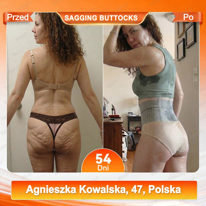 📢 𝐎𝐝𝐤𝐫𝐲𝐣 𝐭𝐨 𝐧𝐚 𝐓𝐢𝐤𝐓𝐨𝐤𝐮 – 𝐭𝐨 𝐧𝐨𝐰𝐲 𝐊𝐤𝐢𝐨® 👩 𝟒 𝐰 𝟏 – 𝐦𝐨𝐝𝐞𝐥𝐮𝐣ą𝐜𝐲 𝐢 𝐰𝐲𝐬𝐳𝐜𝐳𝐮𝐩𝐥𝐚𝐣ą𝐜𝐲 𝐤𝐫ó𝐭𝐤𝐢 𝐩𝐥𝐚𝐬𝐭𝐞𝐫 𝐦𝐢𝐤𝐫𝐨𝐢𝐠ł𝐨𝐰𝐲 𝐳 𝐦𝐨𝐫𝐢𝐧𝐠ą 𝐢 𝐛𝐞𝐫𝐛𝐞𝐫𝐲𝐧ą ☘️ 𝐓𝐲𝐥𝐤𝐨 𝐰 𝐨𝐟𝐢𝐜𝐣𝐚𝐥𝐧𝐲𝐦 𝐬𝐤𝐥𝐞𝐩𝐢𝐞 𝐦𝐚𝐫𝐤𝐢 | ✅ 𝐎𝐫𝐲𝐠𝐢𝐧𝐚𝐥𝐧𝐲 𝐩𝐫𝐨𝐝𝐮𝐤𝐭