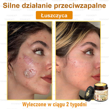🔥  Leurea® Krem z Jadem Pszczelim – Wygładza zmarszczki i przywraca młody wygląd – 50 ml