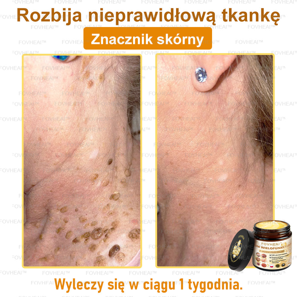 🔥  Leurea® Krem z Jadem Pszczelim – Wygładza zmarszczki i przywraca młody wygląd – 50 ml