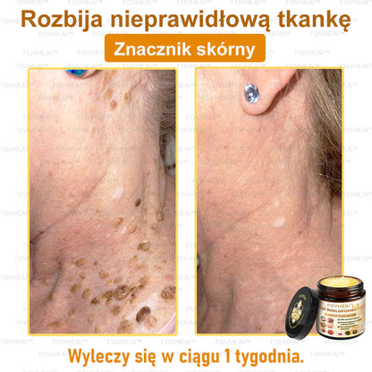 🔥  Leurea® Krem z Jadem Pszczelim – Wygładza zmarszczki i przywraca młody wygląd – 50 ml