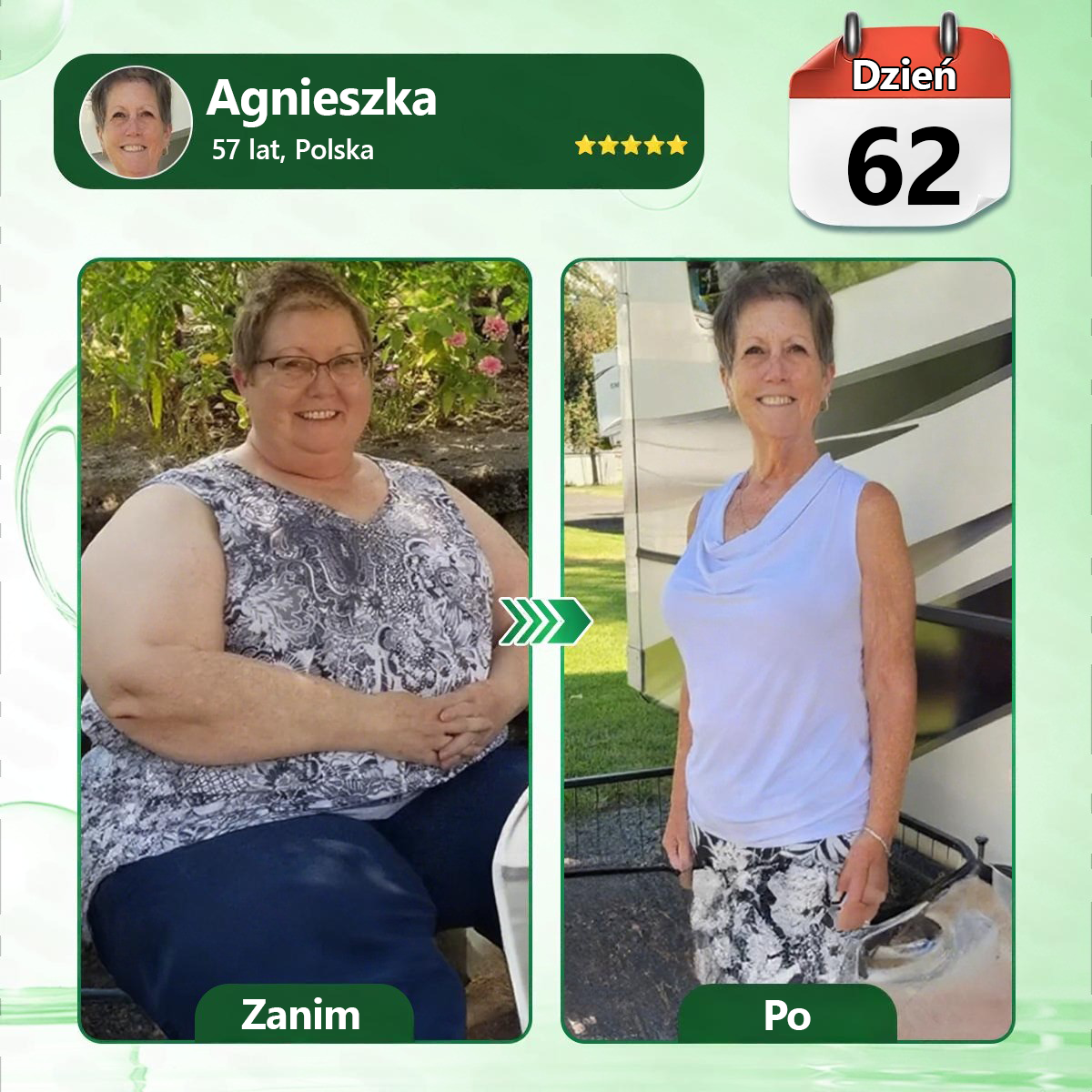 🔥🔥Polska oficjalny sklep | Kkio® Moringa·Berberyna × NAD+ 10 w 1 nano mikroigłowy plaster – codzienne stosowanie, widoczne efekty w ciągu 7 dni ✅ na wagę ciała, skórę, cukrzycę i zdrowie stawów 🗽