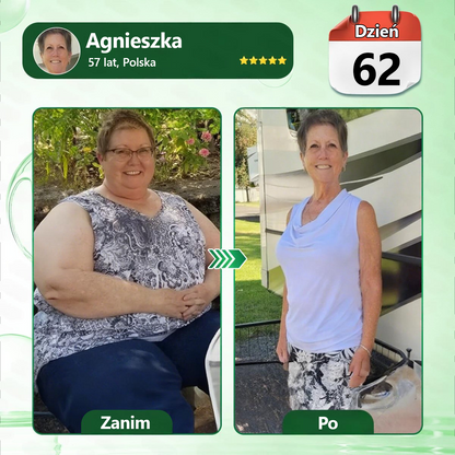 🔥🔥Polska oficjalny sklep | Kkio® Moringa·Berberyna × NAD+ 10 w 1 nano mikroigłowy plaster – codzienne stosowanie, widoczne efekty w ciągu 7 dni ✅ na wagę ciała, skórę, cukrzycę i zdrowie stawów 🗽