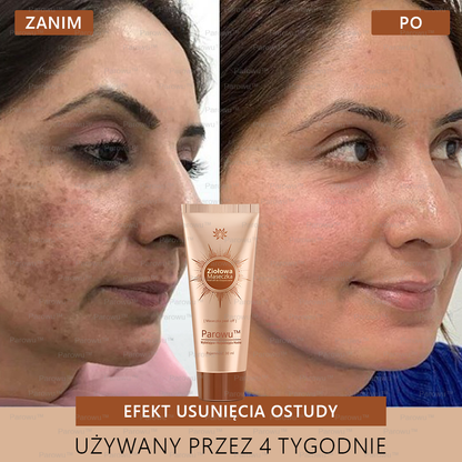 ✨✨🌙Parowu™ Wybielająca i Rozjaśniająca Maska - Naturalne składniki trwale usuwają plamy, piegi i przebarwienia