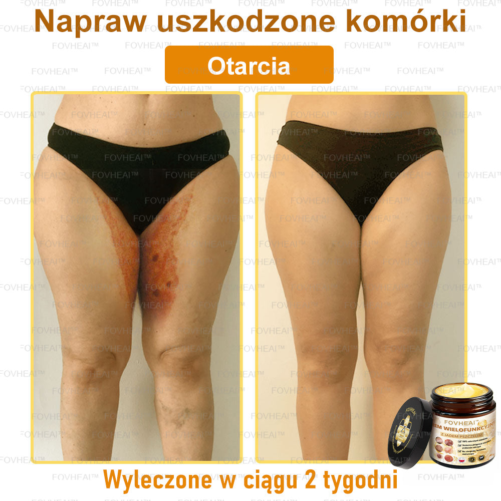 🔥  Leurea® Krem z Jadem Pszczelim – Wygładza zmarszczki i przywraca młody wygląd – 50 ml