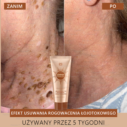 ✨✨🌙Parowu™ Wybielająca i Rozjaśniająca Maska - Naturalne składniki trwale usuwają plamy, piegi i przebarwienia