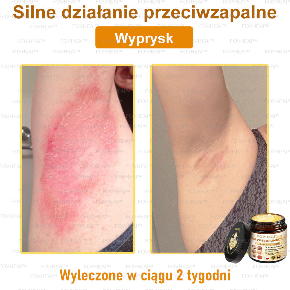 🔥  Leurea® Krem z Jadem Pszczelim – Wygładza zmarszczki i przywraca młody wygląd – 50 ml