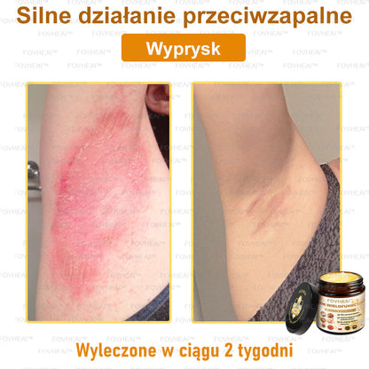🔥  Leurea® Krem z Jadem Pszczelim – Wygładza zmarszczki i przywraca młody wygląd – 50 ml