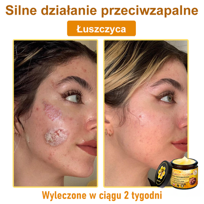 🔥Leurea® Krem z Jadem Pszczelim 🔥 Regeneracja skóry, redukcja zmarszczek i promienny wygląd – 50 ml