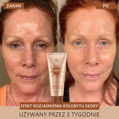 ✨✨🌙Parowu™ Wybielająca i Rozjaśniająca Maska - Naturalne składniki trwale usuwają plamy, piegi i przebarwienia