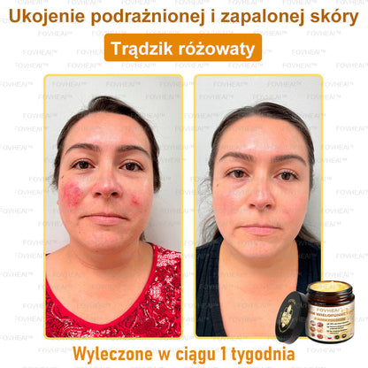 🔥  Leurea® Krem z Jadem Pszczelim – Wygładza zmarszczki i przywraca młody wygląd – 50 ml