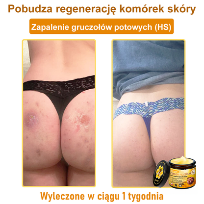 🔥Leurea® Krem z Jadem Pszczelim 🔥 Regeneracja skóry, redukcja zmarszczek i promienny wygląd – 50 ml