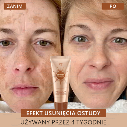 ✨✨🌙Parowu™ Wybielająca i Rozjaśniająca Maska - Naturalne składniki trwale usuwają plamy, piegi i przebarwienia