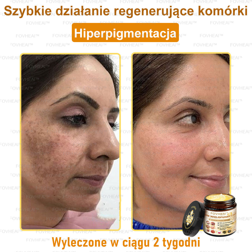 🔥  Leurea® Krem z Jadem Pszczelim – Wygładza zmarszczki i przywraca młody wygląd – 50 ml