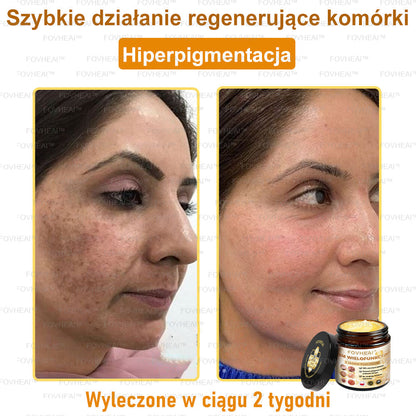🔥  Leurea® Krem z Jadem Pszczelim – Wygładza zmarszczki i przywraca młody wygląd – 50 ml