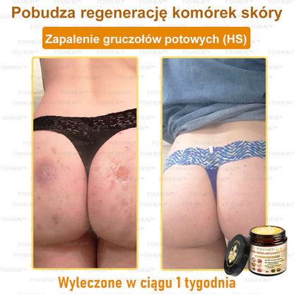 ✨FOVHEAl™ Krem z Jadem Pszczelim – Wygładza zmarszczki i przywraca młody wygląd – 50 ml