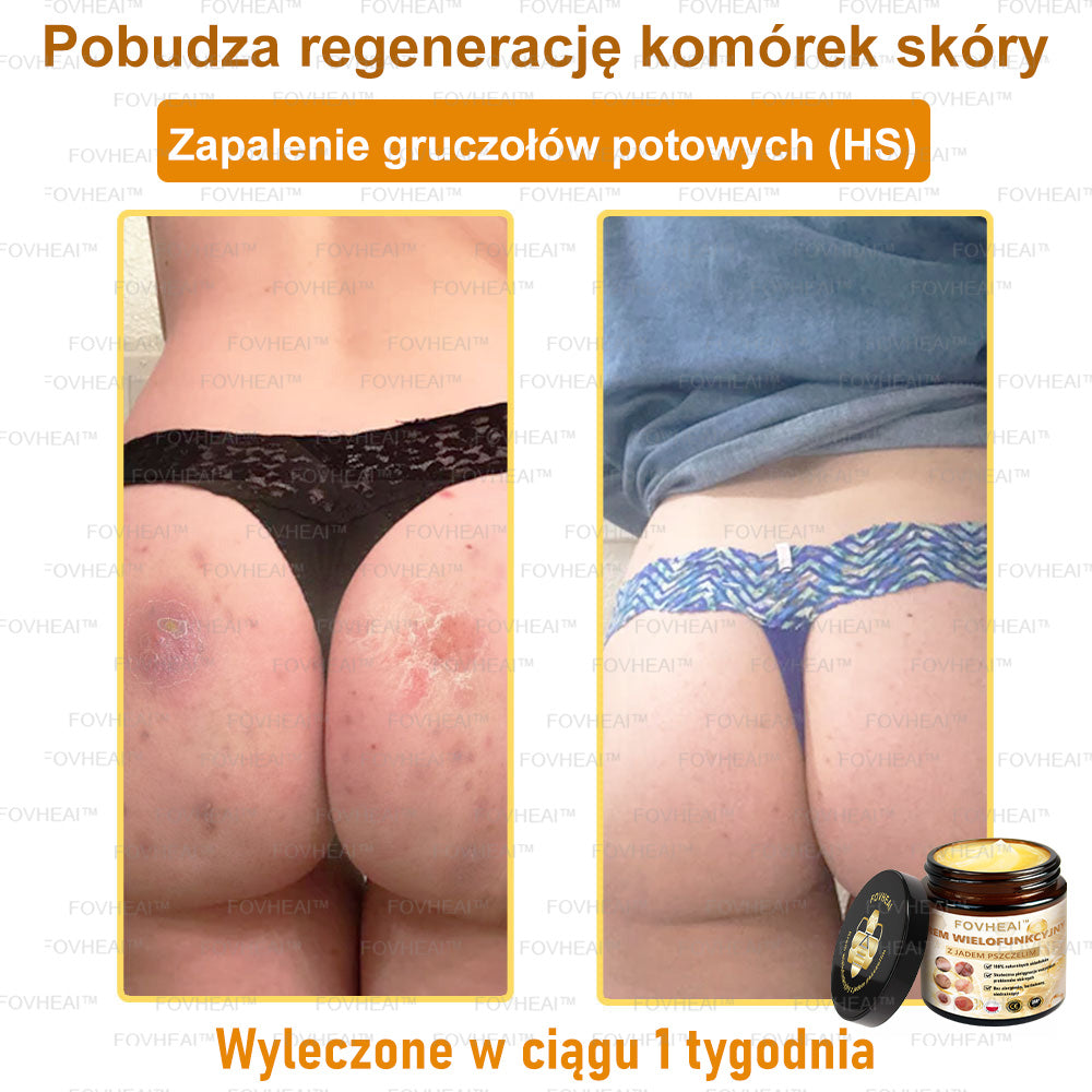 🔥  Leurea® Krem z Jadem Pszczelim – Wygładza zmarszczki i przywraca młody wygląd – 50 ml