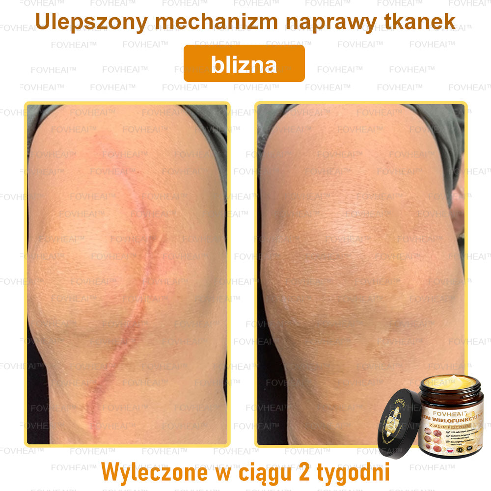 🔥  Leurea® Krem z Jadem Pszczelim – Wygładza zmarszczki i przywraca młody wygląd – 50 ml